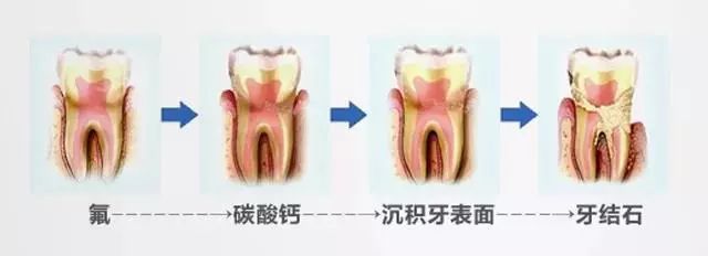 牙黄口臭的克星，有效洁白牙齿，并让口气清新！烟民必备的牙膏