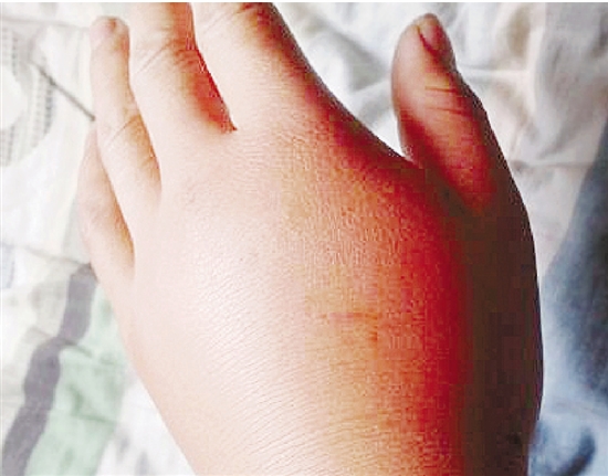 遭遇马蜂的自救法,遭遇马蜂袭击怎么办