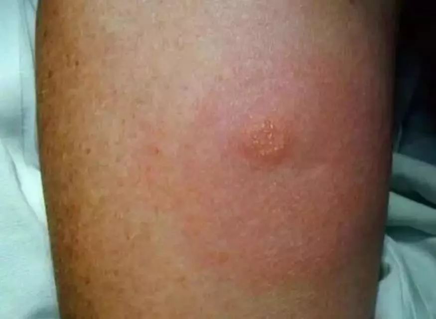 澳大利亚现巨型蜘蛛,澳大利亚巨型蜘蛛在哪出现