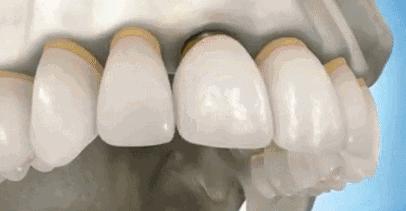 最新武汉垃圾分类消息,武汉垃圾分类怎么样了