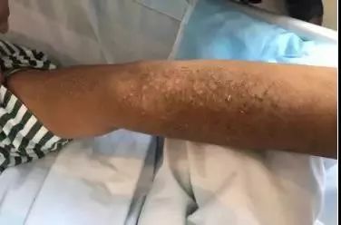 一男子用民间偏方治病险送命！这些偏方都是血淋淋的教训，千万别信