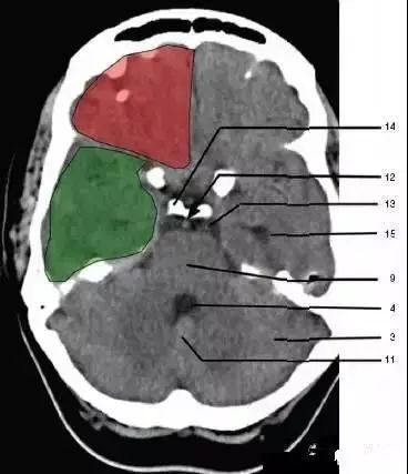 颅脑影像读片教程,颅脑影像读片怎么看