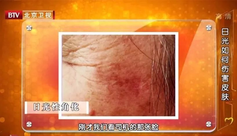 女性过了25岁需要注意的养生知识,25岁以上女性保养身体的方法