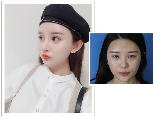 大事件!诺德「校园天使」全城征集!颜值and才艺双双爆表