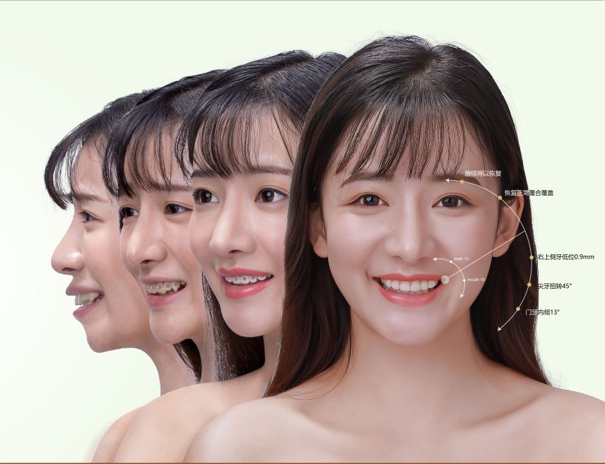 南沙可以报医保的医院,南沙可以刷医保的口腔医院