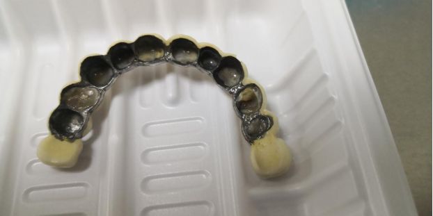 老掉牙怎么办吃什么可缓解,老掉牙什么意思