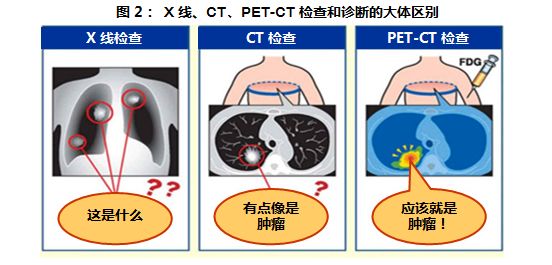 检查癌症最先进的仪器,目前最先进的查癌症的设备是