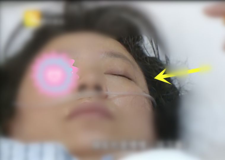 脑子泡在血水里！这种“不定时*弹炸**”很多人都有