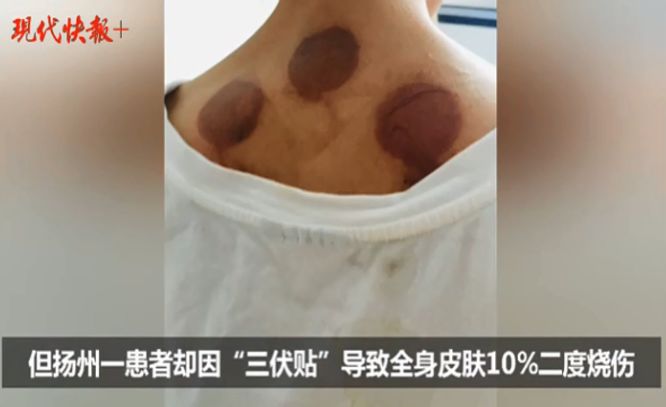 三伏贴卖不好的原因,三伏贴乱象调查