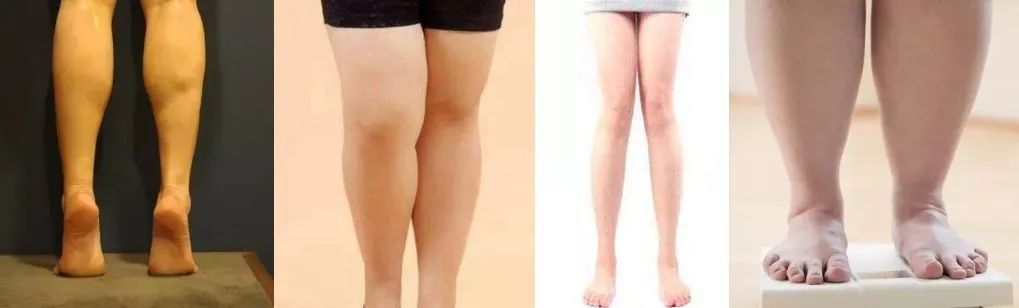 跑完步脚底板很痛但没有起泡,跑完步脚底板一踩就疼怎么回事