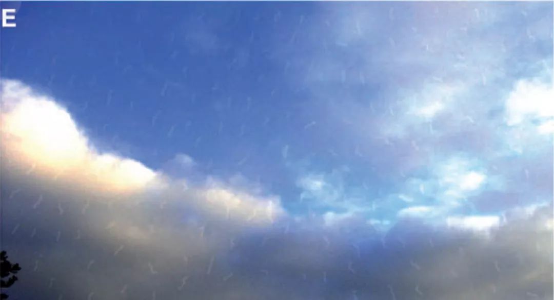 雪花综合征,视觉雪花综合症是先天性的吗