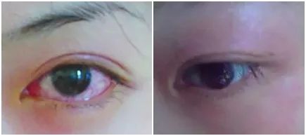 比种睫毛还自然!韩国黑科技假睫毛,不用胶水,一撕一贴3秒搞定,手残*党**都能秒变睫毛精