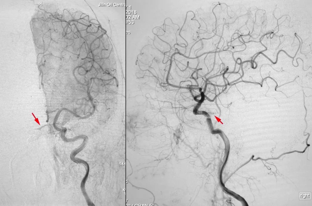 柳暗花明第二集,柳暗花明52集完整版下载