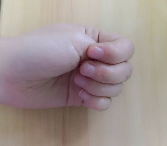 健康：秋来湿未去！有这几个症状的人，你湿气太重了