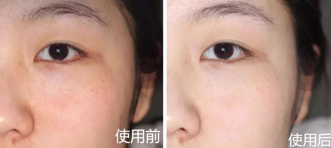 新西兰草本植物精华,新西兰精华液护肤品