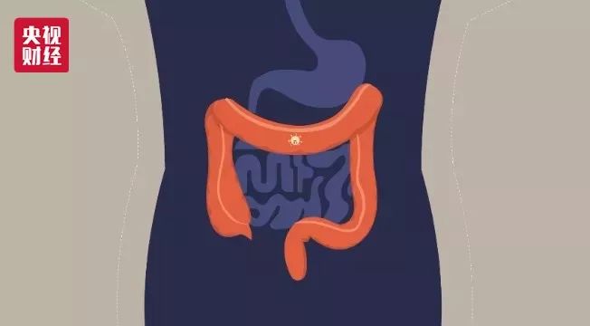 肺癌、胃癌、肝癌…如何体检，才能早发现八大高发癌症？