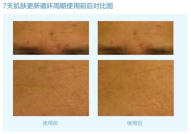 vishya玻尿酸德国价格,德国balea玻尿酸原液使用方法