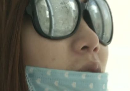 花了三万多隆鼻,隆鼻完15天鼻子痛