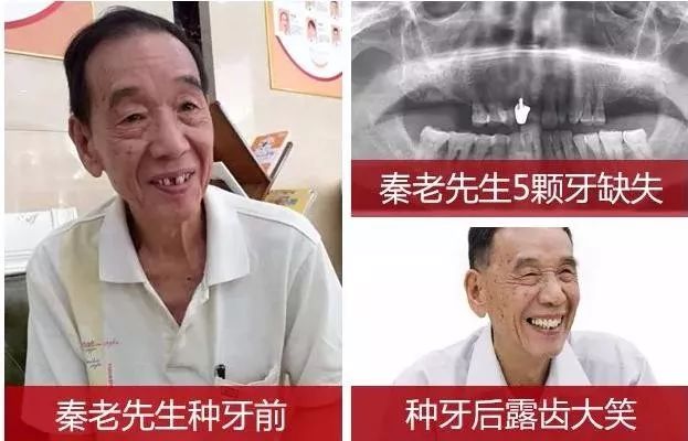 身份证36开头32结尾,身份证开头3756