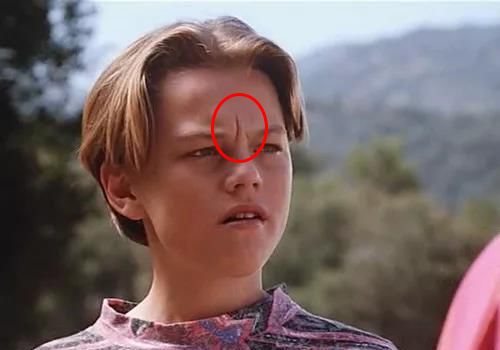 35岁了法令纹鱼尾纹眉间纹怎么办,三十岁就有眉间纹法令纹怎么办