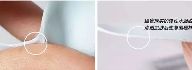 法令纹又黑又长,法令纹又深又长好吗