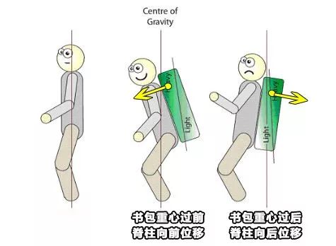 背背佳矫正驼背书包,驼背书包怎么挑选