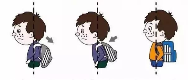 背书包驼背怎么纠正,小孩背书包导致驼背怎么矫正