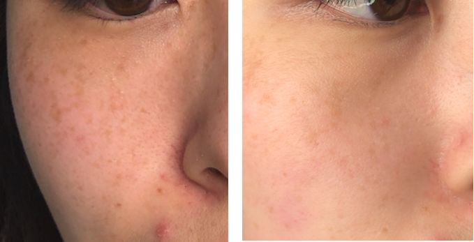 整容明星脸翻车现场,明星整容翻车名场面