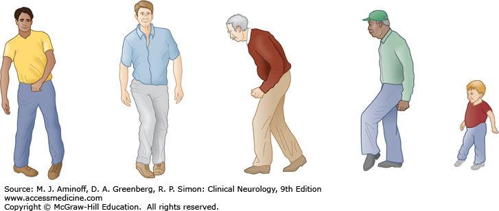 老年人摔倒了千万别着急站起来！正确做法是这样...