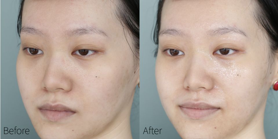 蒂佳婷dr.jart水光蓝丸pro面膜,韩国drjart蒂佳婷黑色面膜要洗吗