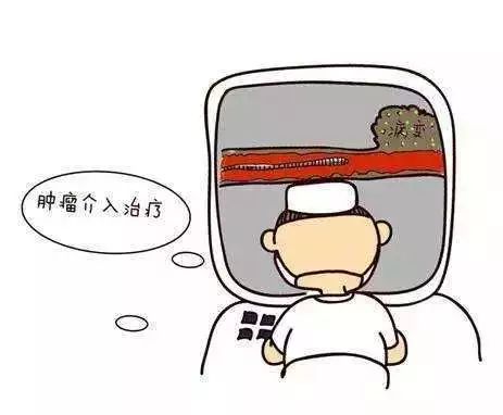 微创介入治疗肿瘤演示,老年肿瘤怎么治疗最有效