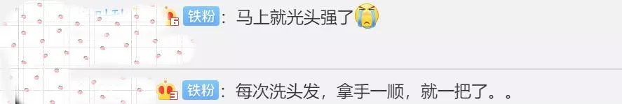 杭州95后小伙掉发严重,杭州95后小伙脱发