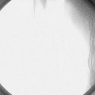 冠脉造影技术成熟不,跟我学技术分析从入门到精通