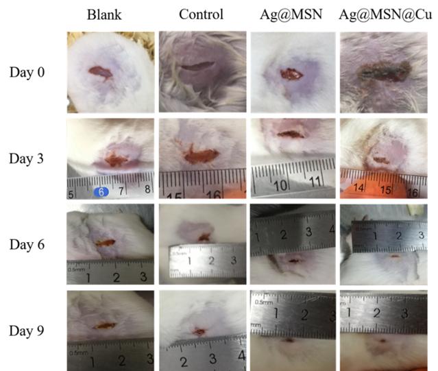 伤口愈合胶水,神奇胶水