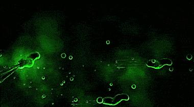 阿莫西林能彻底根除幽门螺杆菌吗,幽门螺杆菌杀一次失败了怎么办