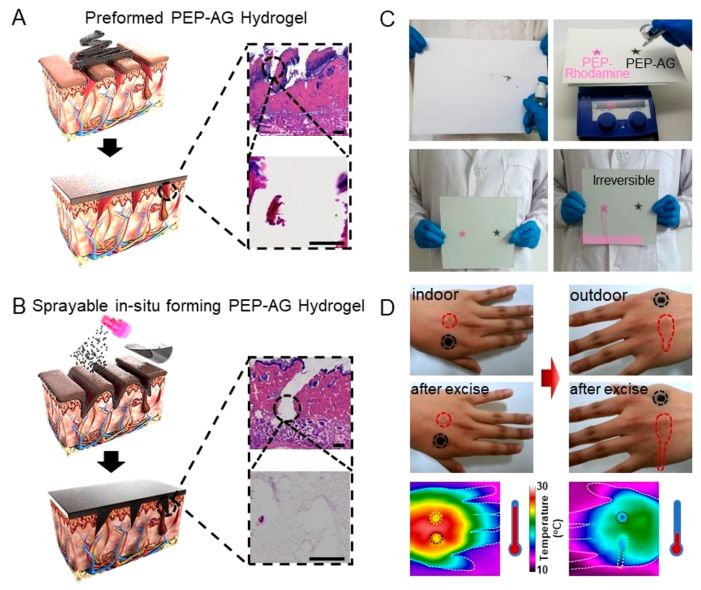 只需喷一喷？合肥工大学者研发出用于耐药性细菌感染伤口处理的可喷涂原位成型水凝胶