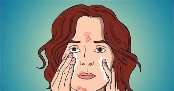 为什么维a酸能治痘,治疗痘痘的维a酸乳膏你用对了吗