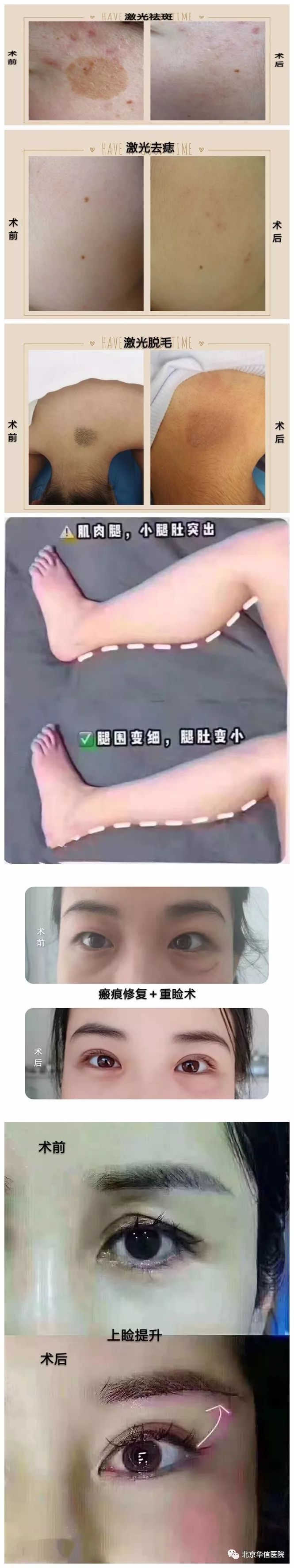 「庆甲子华诞护百姓健康」皮肤美容科还您美丽容颜