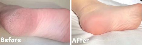 日本人吃饭都不穿鞋，熏死人了！这双耗时3年的黑科技银离子袜，美白润肤自发热，穿7天都不臭脚