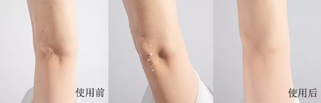 去黑头日本洗面奶,日本去角质保湿洗面奶