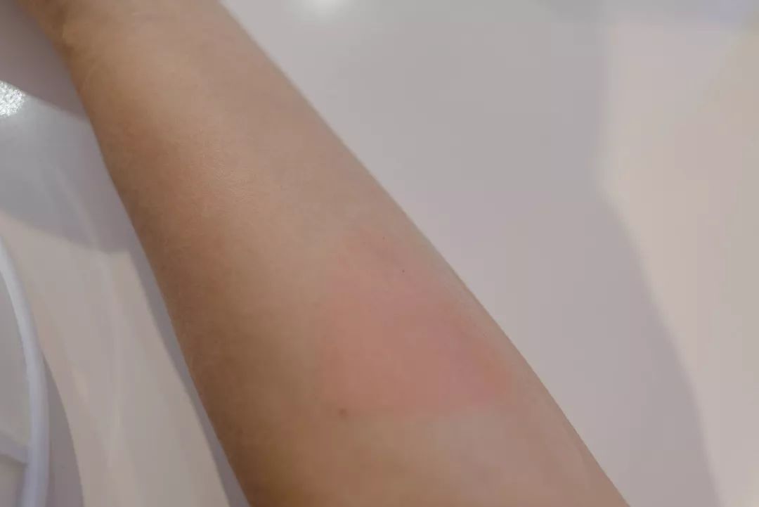 水润瓷肌,白瓷肌护肤