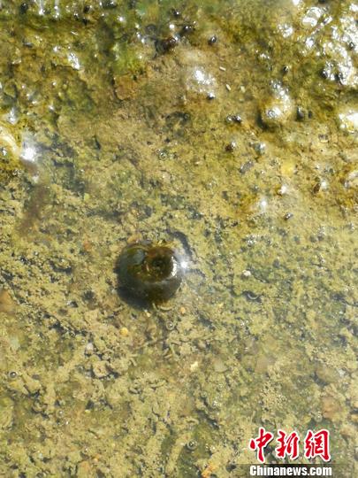 曼氏迭宫绦虫裂头蚴常见寄生位置,曼氏血吸虫蠕虫