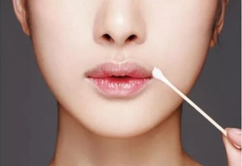 嘴唇干裂脱皮用什么润唇膏好,嘴巴一直脱皮干裂可以用润唇膏吗