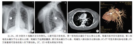 阜外医院心内科华伟,阜外心内科华伟