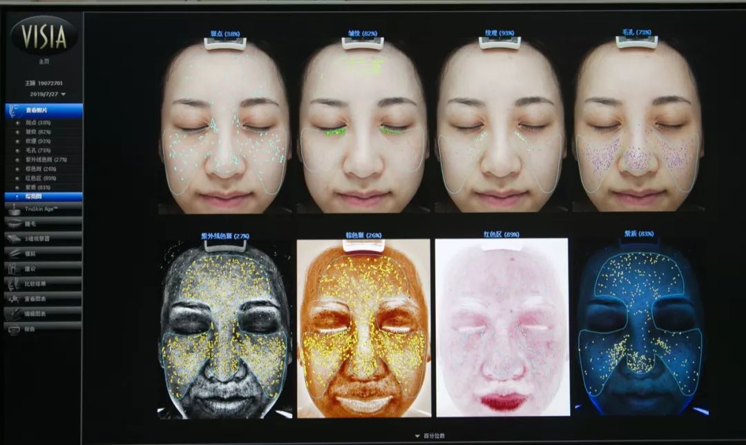 肌诊室·特别版|真人体验，医美素颜光vs明星微精华，改善皮肤哪家强？