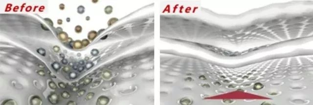 法令纹和眼纹怎么才能有效改善,法令纹贴眼贴有用吗