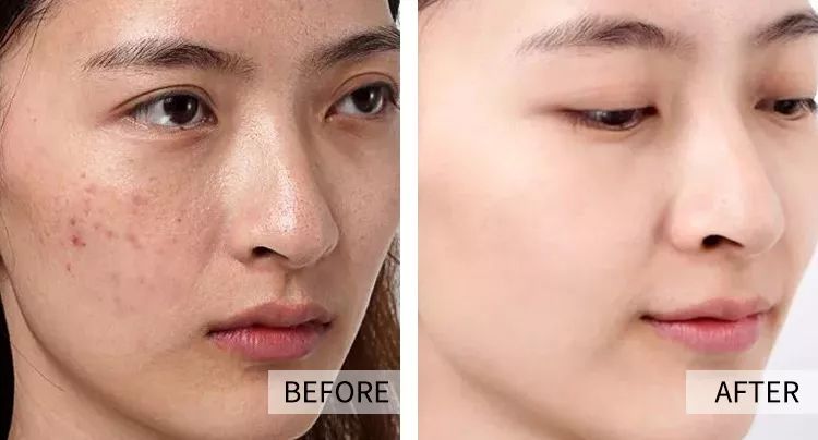 秋冬超级爆款面霜医用,秋冬面霜保湿滋润成人用推荐国货