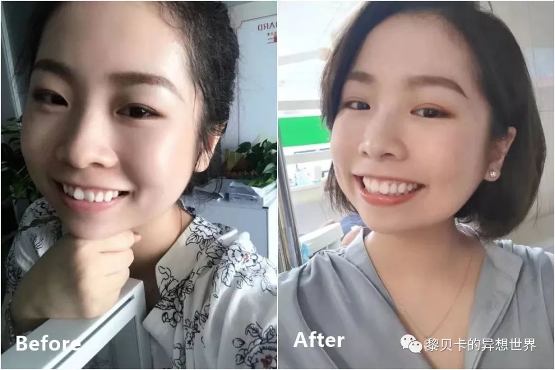 最短只要一年，这件事做对了堪比整容