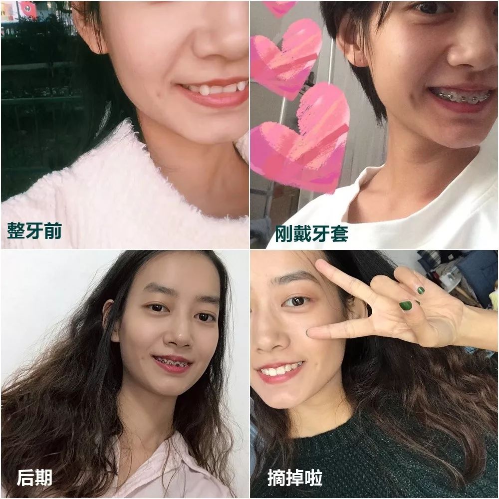 最短只要一年，这件事做对了堪比整容