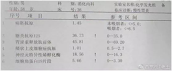 吸烟30年肺部ct图片,抽烟十年20年30年肺部的真实影像